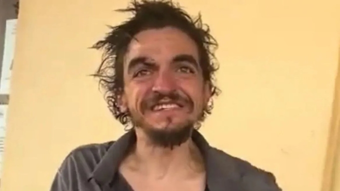 He was found on the streets last week. Picture: TMZ