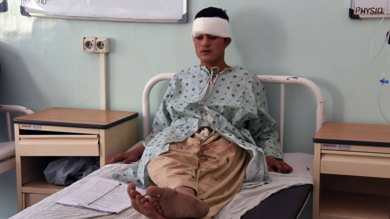 A wounded Afghan man sits on a bed at a hospital after a minivan stuffed with explosives detonated in Kandahar on Tuesday. (Javed Tanveer/AFP/Getty Images)