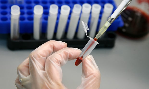 A laboratory technician examines blood samples for HIV and Aids. Photograph: Eliseo Fernandez/Reuters/Corbi