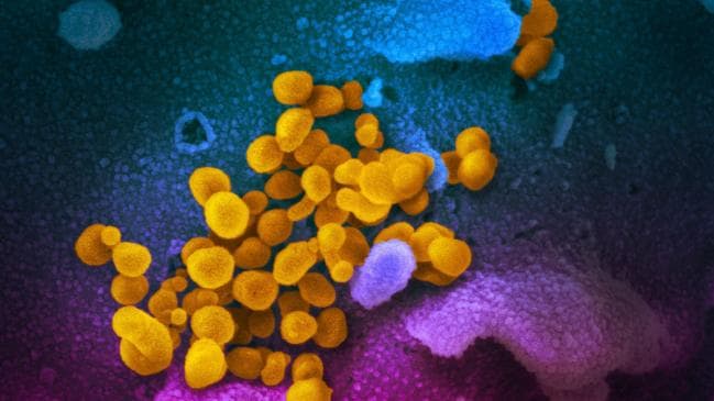 SARS-CoV-2 (yellow) shown through a scanning electron microscope is mutating and now has eight strains. Picture: National Institutes of Health / AFPSource:AFP