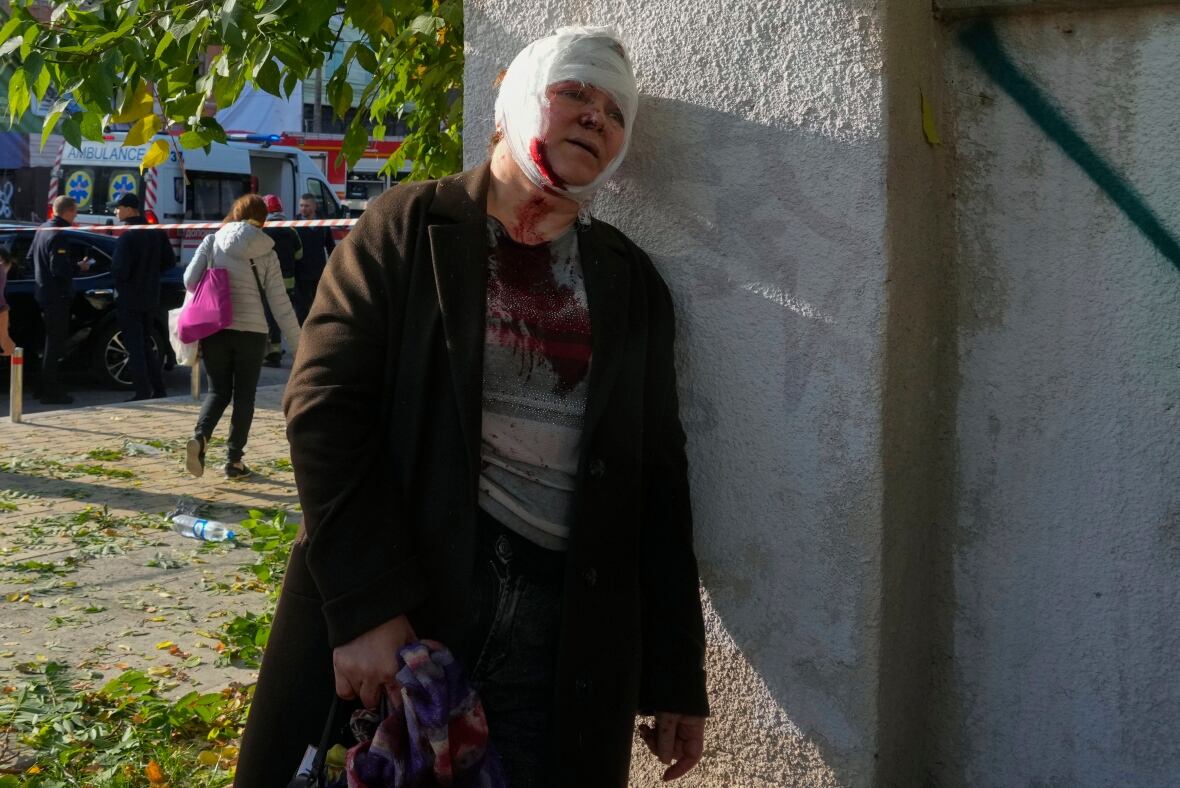 An injured woman reacts after Russian shelling in Kyiv on Monday. Western military experts say such intense attacks are unsustainable and not a winning war strategy. (Efrem Lukatsky/The Associated Press)