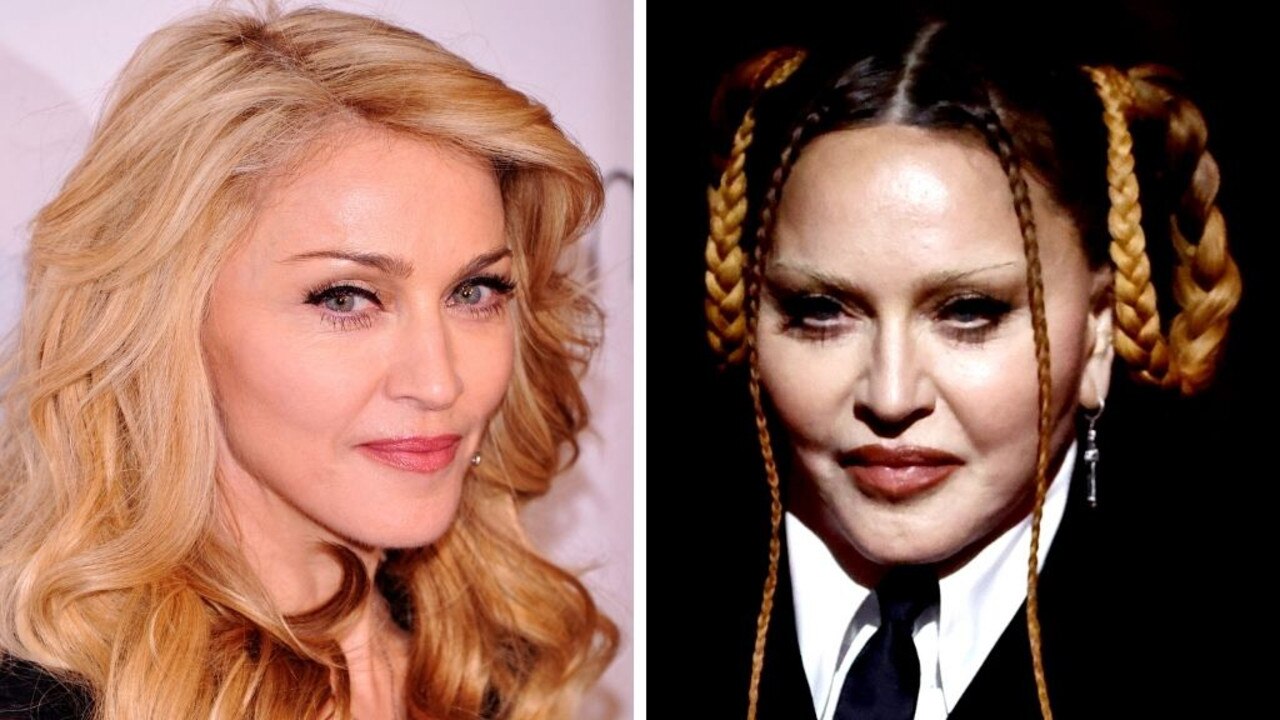 Madonna has been defiant, clapping back at critics who take issue with her appearance. Pictures: Getty Madonna a ‘sick person who needs help’